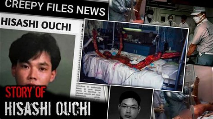 Hisashi Ouchi Real Photos: A Deep Dive into the Life and Legacy of a Tragic Event