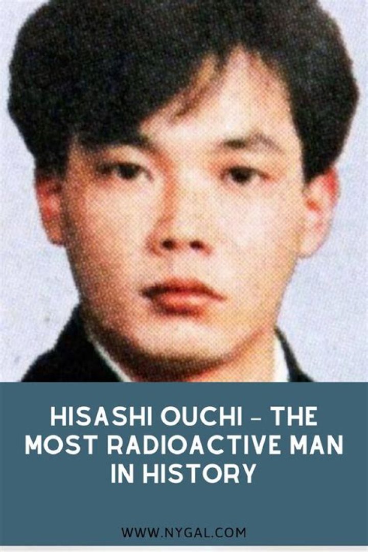 Hisashi Ouchi: The Real Story Behind the Photos and Tragic History